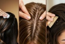 Winter Dry Scalp: Causes, Treatments, and Prevention Tips